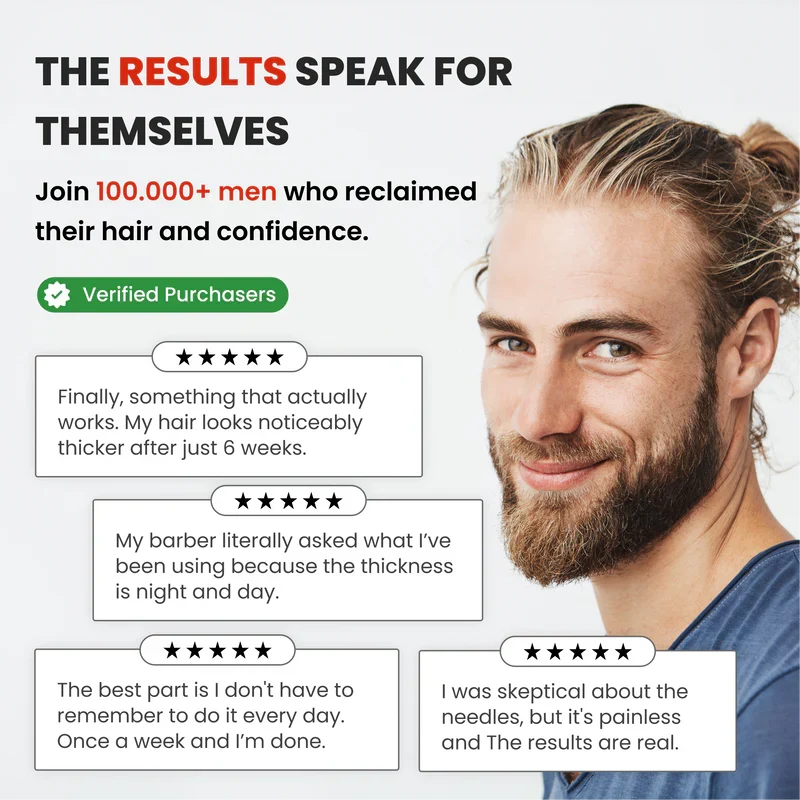 AlphaFusion™ Hair Regrowth System