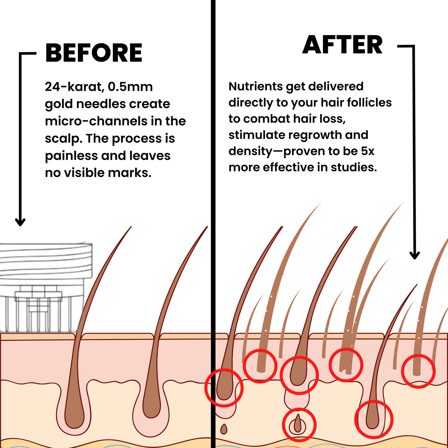 AlphaFusion™ Hair Regrowth System